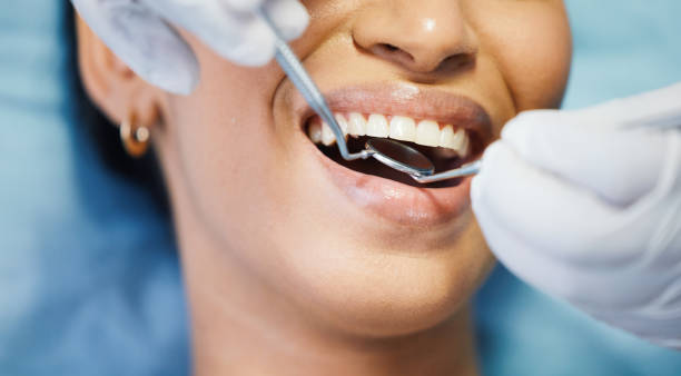 Best Emergency Treatment for Dental Infections or Abscesses in Ladera Heights, CA